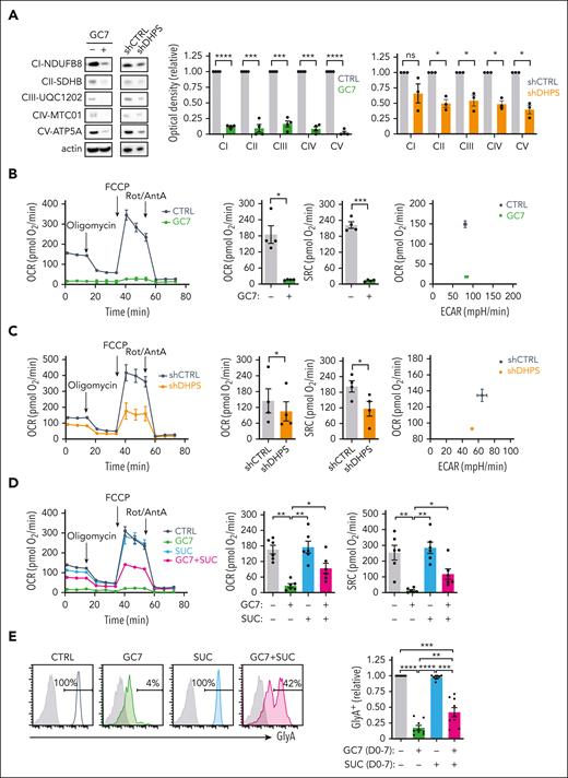 Hypusination-induced OXPHOS is required for the erythroid commitment of hematopoietic progenitors. (A) Mitochondrial complexes (CI to CV) were monitored on progenitors treated with GC7 or after transduction with shCTRL or shDHPS vectors (day 3) using the OXPHOS monoclonal antibody cocktail (left). Quantification relative to control conditions was determined (n = 4 for GC7 and n = 3 for shRNA-transduced progenitors; middle and right, respectively). (B) Oxygen consumption rate (OCR), a measure of OXPHOS, was monitored on day 1 of erythroid differentiation in the absence or presence of GC7 (5 μM) on a Seahorse XFe96 analyzer after sequential injection of oligomycin, carbonyl cyanide 4-(trifluoromethoxy) phenylhydrazone (FCCP), and Rotenone/Antimycin A (Rot/AntA; arrows, left). Mean basal OCR and SRC levels ± standard error of the mean (SEM) are presented (middle, n = 4). Representative energy plots of basal OCR and extracellular acidification rate (ECAR), a measure of glycolysis, are presented (right). (C) OCR was monitored on fluorescence-activated cell sorter–sorted shCTRL- and shDHPS-transduced progenitors at day 1 of differentiation (left). Basal OCR and SRC levels ± SEM were evaluated in 4 independent experiments (middle) and a representative OCR/ECAR energy plot is presented (right). (D) OCR was monitored on CD34+ progenitors differentiated with EPO for 24 hours in the absence or presence of GC7 (5 μM) and succinate (SUC, 5 mM) and representative graphs are shown (left). Basal OCR and SRC levels in 6 independent experiments are presented (right). (E) Erythroid differentiation in progenitors treated with EPO in the absence or presence of GC7 or succinate was evaluated at day 7 as a function of GlyA expression and representative histograms are shown (left). Quantification of the percentages of GlyA+ cells relative to control conditions are presented (right, n = 9). ∗P < .05; ∗∗P < .01; ∗∗∗P < .001, ∗∗∗∗P < .0001.