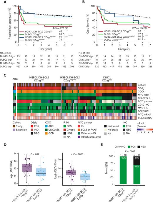 The clinical and molecular characteristics of DZsig positive (DZsigpos) tumors in relation to HGBCL-DH-BCL2. (A-B) FFP and OS of patients treated with R-CHOP harboring DZsigpos tumors in the presence or absence of a FISH-based diagnosis of HGBCL-DH-BCL2 (HGBCL-DH-BCL2 DZsigpos vs DLBCL DZsigpos respectively), including the small subset of HGBCL-DH-BCL2 tumors that lack DZsig expression (HGBCL-DH-BCL2 DZsigneg/ind). DLBCL DZsigneg/ind are the remaining majority of patients with DLBCL, NOS. Patients harboring tumors with evaluable FISH and GEP data were included. Patients with HGBCL with MYC and BCL6 rearrangements (n = 8) were included in the DLBCL groups. Two patients with ABC tumors that are DZsigpos were excluded from the analysis. Log-rank test was used to compare survival curves. ∗∗∗∗P < .0001, ∗∗∗P < .001, ∗P < .05. (C) Molecular characterization of HGBCL-DH-BCL2-DZsigpos, DLBCL DZsigpos, and the HGBCL-DH-BCL2 DZsigneg/ind in a cohort combining the study population and extension cohort (1112 evaluable biopsies). Tumors were profiled by: (1) Digital GEP by the DLBCL90 assay for COO, DZsig, and relative MYC and BCL2 mRNA expression (z scores) displayed as a heat map in the bottom 2 rows. (2) FISH for MYC and BCL2 rearrangements. (3) Targeted capture or whole genome sequencing to identify MYC rearrangement partner in MYC rearranged tumors. (4) IHC for MYC, BCL2 and the GC marker CD10. “ABC” is a separate track of rare ABC tumors (n = 3) that were DZsigpos (marked with ∗, as not applicable in ABC) and/or HGBCL-DH-BCL2, which were excluded from subsequent analysis. (D) Box plots showing relative mRNA expression of MYC (left) and BCL2 (right) in HGBCL-DH-BCL2-DZsigpos tumors vs HGBCL-DH-BCL2 DZsigneg/ind shown as z scores from log2 normalized counts with means compared by t test. (E) Proportion of tumors positive for CD10 by IHC in HGBCL-DH-BCL2-DZsigpos vs HGBCL-DH-BCL2 DZsigneg/ind compared by Fisher exact test. IG, immunoglobulin; ind, indeterminate DZsig; mRNA, messenger RNA; UNCLASS, unclassified COO.