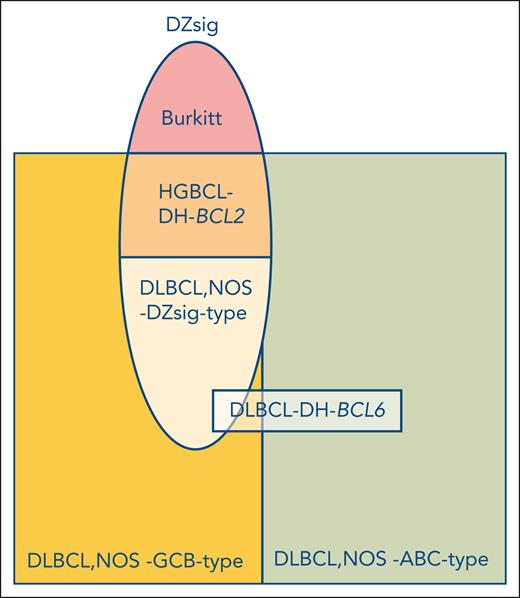 A COO-based classification of aggressive B-cell lymphomas. The newly described DZsig (oval), that is defined by a normal germinal center dark zone centroblast profile, identifies a group of DLBCLs that were originally predominantly included in the GCB gene-expression class (yellow). DZsig brings together cases with a dismal outcome (approximately 60% 2-year overall survival). The remaining DLBCL, not otherwise specified (NOS)-GCB-type cases are also distinct and characterized by an excellent outcome (approximately 90% 2-year overall survival). At the DNA level, however, DZsig is heterogeneous, containing approximately one-third lymphomas with concomitant MYC and BCL2 rearrangements (HGBCL-DH-BCL2, mid-oval, orange) and two-thirds without this genetic aberration (lower part of oval, light orange). The genetic composition of the latter group remains to be elucidated. It should be noted that the DZsig gene-expression profile is not specific for DLBCL, however, and extends beyond this entity since it is also a consistent feature of Burkitt lymphoma (top of oval, pink). How DLBCL with concomitant MYC and BCL6 rearrangements (DLBCL-DH-BCL6) may relate to this novel COO classification is not fully resolved.