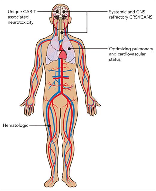 CAR-T toxicities affect many systems. Professional illustration by Patrick Lane, ScEYEnce Studios.