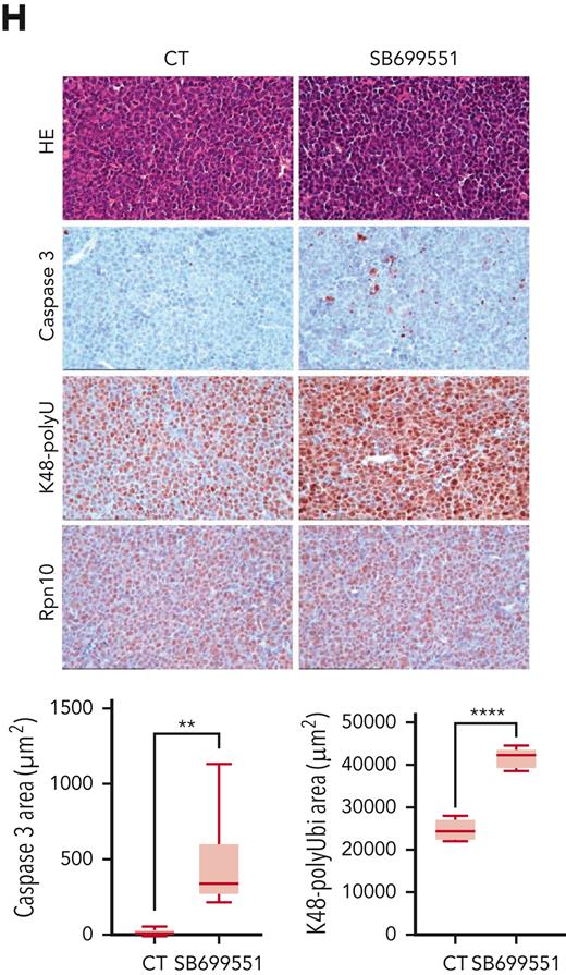 Anti-MM activity of SB. (A) MM, melanoma, leukemia, and lymphoma cell lines were treated with dimethyl sulfoxide (DMSO) control or SB at different concentrations for 48 hours, followed by assessment for cell viability using a WST assay (P < .05 for all cell lines, n = 3). IC50 was calculated and presented in the table. (B) Purified CD138+ cells from a patient with MM were treated with DMSO or SB for 48 hours, followed by assessment for cell viability using a CTG assay (mean ± SD of triplicate cultures). (C) Normal PBMCs from healthy donors were treated with DMSO or the indicated concentrations of SB for 48 hours, and then analyzed for cell viability using a CTG assay (mean ± SD, n = 3, P value is ns). (D-E) MM.1S cells were cultured with or without pDCs or BMSCs in the presence or absence of indicated concentrations of SB for 48 hours, and then cell viability was measured by a WST assay (mean ± SD, n = 3). (F) Total BM-derived mononuclear cells from patients with MM (n = 3) were treated with Rpn10 inhibitor SB (nontoxic concentration of 0.5 μM) or DMSO control for 2 days, and multicolor flow analysis was used to assess MM cell lysis. CD138+ MM cells were quantified by staining with CD138-FITC Ab. Representative fluorescence-active cell sorter scatter plot showing a decrease in the number of viable fluorescein isothiocyanate–positive MM cells after treatment with SB (left) and bar graph shows quantification of CD138+ MM cells in the left panel (right) are shown. The fold change was obtained after normalization with control data and presented as percentage of viable cells in the presence vs absence of SB (mean ± SD, P < .05). (G) Mice bearing human MM.1S MM tumors were treated with either vehicle control or SB (20 mg/kg, intraperitoneally) 3 times weekly for 14 days. Average and SD of tumor volume (mm3) is shown vs time when tumor was measured (mean tumor volume ±SD, 10 mice per group) (left top) and Kaplan-Meier plots show survival in mice (left bottom) are shown. SB-treated mice showed increased survival vs control vehicle-treated mice. Tumor lysates from control vehicle- and SB-treated mice were subjected to immunoblot analysis using anti–caspase-3, caspase-9, K48 polyubiquitin, and β-actin (right). (H) Representative hematoxylin and eosin (HE) and immunohistochemistry stains of caspase-3, K48 polyubiquitin and Rpn10 in tumor tissue from control- and SB-treated mice. Scale bars, 100 μM.