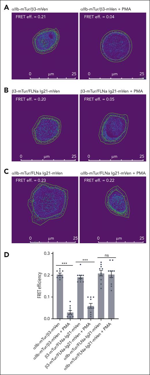 Distinct associations of filamin with inactive and active integrin αIIbβ3 cytoplasmic face. Representative images of FRET efficiency using acceptor (mVenus) photobleaching of mTurquoise-mVenus pair transfected in CHO-K1 cells. Rings outlining the cell membrane were selected as the region of interest. Intensities within the region of interest before and after bleach were counted using Image Pro Plus 7 and used for calculating FRET efficiency (FRET effi.). Ten cells in each group were analyzed (see supplemental Figure 2A-F). A separation >100 Å between mTur and mVen would abolish FRET. (A) FRET of αIIb-mTur/β3-mVen pair without PMA treatment (left) shows good FRET efficiency, consistent with the association of αIIb/β3 CTs. Upon PMA treatment (right), the FRET efficiency is reduced, consistent with the separation of αIIb/β3 CTs upon integrin activation. (B) FRET of β3-mTur/FLNa Ig21-mVen pair without PMA treatment (left) shows good FRET efficiency, consistent with filamin association with β3 CT in the resting state of integrin. Upon PMA treatment (right), the FRET efficiency is reduced indicating the dissociation of filamin from β3 CT. (C) FRET of αIIb-mTur/FLNa Ig21-mVen pair with (right) and without (left) PMA treatment shows similar FRET efficiency, indicating that filamin remains associated with αIIb CT in both resting and active states of αIIbβ3. (D) Bar plot for FRET measured for αIIb-mTur/β3-mVen, or PC-αIIb/β3-mTur/FLNa Ig21-mVen, αIIb-mTur/PC-β3/FLNa Ig21-mVen cotransfected in CHO-K1 cells with or without PMA treatment. Data are average values ± SEM for 10 cells. ∗∗∗P < .001; ∗P > .05. SEM, standard error of mean; ns, nonsignificant.