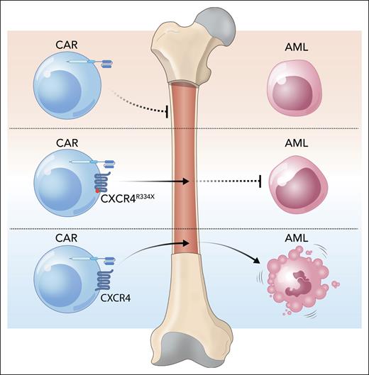 CXCR4 helps CAR-CIK cells reach the BM and eliminate AML. Adding CXCR4, a chemokine receptor, to CAR-CIK cells increases their homing to the BM and also improves cytotoxic activity against AML. Mutant CXCR4R334X improves BM homing but does not increase CAR-CIK cell cytotoxicity. Professional illustration by Somersault18:24.