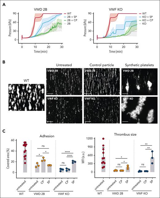 In vitro effect of SP nanoparticles added to VWD murine blood in perfusion assays. (A) SPs or CP were added to VWD-2B blood (left panel) or to VWF-KO blood (right panel) at a ratio of 50 particles per platelet. Particle-supplemented blood or unsupplemented blood (untreated) was perfused over AR chips in the T-TAS Plus system. Graphs represent changes in pressure (a measure for thrombus formation) as a function of time. The colored area represents the standard error of the mean for each condition. Statistical analysis was performed using a one-way ANOVA with Tukey's correction. (B-C) SPs or CP were added to VWD-2B murine blood or to VWF-KO murine blood at a ratio of 50 particles per platelet. Particle-supplemented blood or unsupplemented blood (untreated) was perfused over collagen in a parallel flow chamber at 1500 s−1. untreated representative images of thrombus formation are shown in B while percentage platelet coverage, representing adhesion or mean fluorescence intensity as a marker of thrombus size are represented in C. Results obtained with untreated WT murine blood is shown for comparison. Data are presented as mean ± SD, n = 3. Statistical analysis was performed using a one-way ANOVA with Tukey's correction. ∗P ≤ .05; ∗∗P ≤ .01; ∗∗∗∗P ≤ .0001. a.u., arbitrary units; ns, not significant.