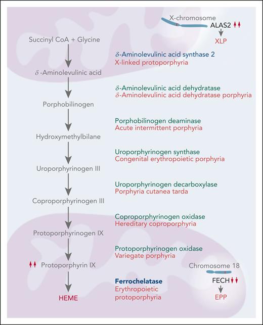 The heme biosynthetic pathway. Heme biosynthesis occurs by 8 sequential enzymatic steps. Decreased activity of ferrochelatase, the final enzyme in the pathway, leads to EPP. XLP is caused by gain-of-function mutations in ALAS2, the enzyme that catalyzes the initial step in this pathway within the erythroblast.