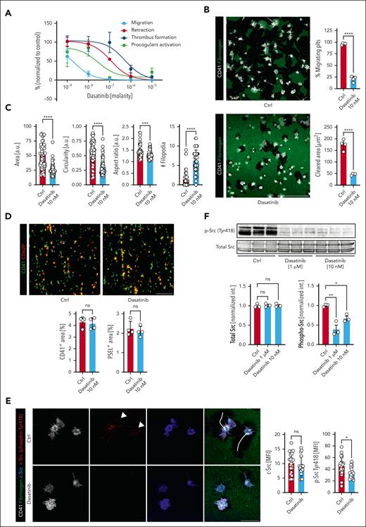 The c-Src inhibitor dasatanib exhibits a low threshold for migration inhibition. (A) Dose-response curves of human platelets in migration, retraction, activation and in vitro thrombus formation assays to doses of dasatinib (10 μM – 1 nM), normalized to sham-treated samples (%). Supplemental Figure 4F-G for corresponding micrographs and statistical analyses. (B) Representative micrographs of confocal images of human platelets migrating on fibrinogen-albumin matrices treated with 10 nM dasatinib or PBS. Quantification of migrating platelets and the cleared area per cell (μm2) (n = 4 biological replicates). Student t test, 2-tailed, unpaired. Scale bar, 50 μm. (C) Cell-based shape analysis of cell size, circularity, aspect ratio and the number (#) of filopodia of migrating platelets exposed to sham treatment or dasatinib 10 nM. Student t test, 2-tailed, unpaired. (D) Representative micrographs of confocal images of whole blood pretreated with sham treatment or dasatinib 10 nM superfused over a collagen matrix (shear rate 1000/s). Scale bar, 50 μm. Quantification of CD41- and P-selectin (PSEL)/CD62P-positive areas. n = 4. Student t test, 2-tailed, unpaired. (E) Representative confocal images of migrating human platelets treated with dasatinib 10 nM or vehicle and stained for CD41 (white), total c-Src (blue) and phospho-c-Src (Tyr418, red). Scale bar, 10 μm. White arrowheads indicate punctual phospho-c-Src localization at the leading edge, white lines represent migration tracks. Right panels: cell-based quantification of MFI of > 50 platelets from n = 2 biological replicates. (F) Representative western blots of human platelet lysates (n = 3) treated with vehicle or dasatinib before activation with ADP and thromboxane. Lower panels: quantification of densitometry. One-way ANOVA with post hoc Dunnett’s testing. Unless indicated with asterisks, post hoc testing revealed nonsignificant results (P ≥ .05). P values corresponding to asterisks: ∗P < .05, ∗∗P < .01, ∗∗∗P < .01, ∗∗∗∗P < .001.