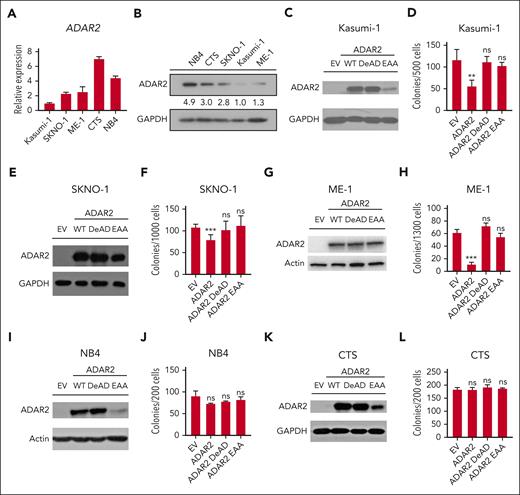 ADAR2 specifically represses the clonogenic growth of CBF AML cells dependent on the RNA editing capability of ADAR2. (A) Bar chart presents reverse transcription-qPCR analysis of ADAR2 expression in Kasumi-1, SKNO-1, ME-1, CTS, and NB4 cells. The relative expression was calculated as described in supplemental Materials and Methods. Data were presented as the mean ± SD of technical replicates from a representative experiment. (B) Western blot analysis of ADAR2 protein expression in Kasumi-1, SKNO-1, ME-1, CTS, and NB4 cells. Glyceraldehyde-3-phosphate dehydrogenase (GAPDH) was used as a loading control. The numbers below the lanes represent the relative protein level, which was determined by the band intensity using Photoshop CC software and normalized to the value of Kasumi-1. Western blot analysis of ADAR2 protein in Kasumi-1 (C), SKNO-1 (E), ME-1 (G), NB4 (I), and CTS (K) cells stably expressing the WT or mutant form of ADAR2 or the EV control via retroviral transduction. GAPDH or actin was used as a loading control. (D,F,H,J,L) Bar chart illustrating the number of colonies formed by the indicated cell groups described in panels C, E, G, I, and K, respectively. Data were presented as the mean ± SD of technical replicates from a representative experiment. (∗∗P < .01; ∗∗∗P < .001 using two-tailed Student t test.)
