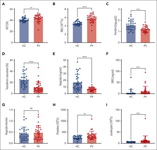 Iron and erythroid parameters in patients with PV and healthy controls. HCT (A), red blood cells (RBCs) (B), ferritin (C), transferrin saturation (D), serum hepcidin (E), serum ERFE (F), hepcidin-to-ferritin ratio (G), platelet count (H), and leukocyte count (I) of healthy controls (HC; blue) and patients with PV (red) (PV and HC, n = 30 each). Mann-Whitney test for panels A,D-I or unpaired 2-tailed t test with Welch correction for panels B-C. ∗∗P < .01; ∗∗∗P < .001; ∗∗∗∗P < .0001. HCT, hematocrit; ns, nonsignificant.