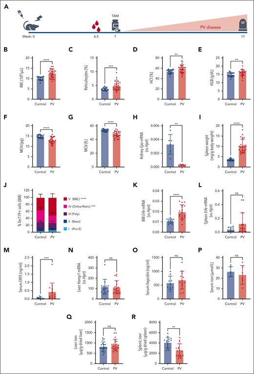 Novel mouse model of PV. (A) Schematic of BM transplant PV mouse model. (B-G) RBCs (B), reticulocytes (C), HCT (D), HGB (E), MCH (F), and MCV (G); control, n = 24 control and PV, n = 25. (H) Kidney Epo mRNA expression relative to Hprt; n = 6. (I) Spleen weight normalized to total body weight; n = 24. (J) Terminal erythropoiesis in the BM determined by flow cytometry. Based on CD44 expression and FSC-A, Ter119+ cells were gated into 5 distinct populations: I, proerythroblast (Pro-E); II, basophilic erythroblasts (Baso); III, polychromatic erythroblasts (Poly); IV, orthochromatic erythroblasts and reticulocytes (Ortho/Retic); and V, RBCs. Control, n = 24 control and PV, n = 25. Erfe mRNA expression relative to Hprt in (K) the BM, n = 13 control; PV, n = 17, and (L) the spleen; control, n = 7; PV, n = 14. (M) Serum ERFE; control, n = 14; PV, n = 15. (N) Liver Hamp1 mRNA expression relative to Hprt; control, n = 13; PV, n = 17. (O) Serum hepcidin; control, n = 9 and PV, n = 12. (P) Serum iron; n = 6. (Q) Liver; control, n = 17 and PV, n = 21. (R) Spleen (n = 15) nonheme iron content. Mann-Whitney test for panels B,D,I,L,M,N, unpaired 2-tailed t test with Welch correction for panels C,E-H,K,O-R, or two-way analysis of variance (ANOVA) with Šídák correction for multiple comparisons for panel J. ∗∗P < .01; ∗∗∗P < .001; and ∗∗∗∗P<.0001.