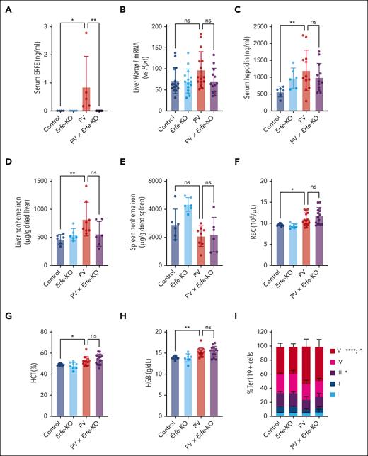 ERFE does not affect hepcidin in PV. (A) Serum ERFE; control, n = 4; Erfe-KO, n = 4; PV, n = 5; and PV × Erfe-KO, n = 11. (B) Liver Hamp1 mRNA expression relative to Hprt; control, n = 15; Erfe-KO, n = 15; PV, n = 15; and PV × Erfe-KO, n = 13. (C) Serum hepcidin; control, n = 4; Erfe-KO, n = 4; PV, n = 12; and PV × Erfe-KO, n = 12. (D) Liver and (E) spleen nonheme iron content; control, n = 6; Erfe-KO, n = 6; PV × Erfe-KO, n = 6; and PV, n = 8. (F-H) RBCs (F), HCT (G), and HGB (H); control, n = 9; Erfe-KO, n = 8; PV, n = 15; and PV × Erfe-KO, n = 14. (I) Terminal erythropoiesis in the BM determined by flow cytometry. Based on CD44 expression and FSC-A, Ter119+ cells were gated into 5 distinct populations: I, proerythroblast (Pro-E); II, basophilic erythroblasts (Baso); III, polychromatic erythroblasts (Poly); IV, orthochromatic erythroblasts and reticulocytes (Ortho/Retic); and V, RBCs; control, n = 9; Erfe-KO, n = 8; PV, n = 13; and PV × Erfe-KO, n = 12. One-way ANOVA for panels A,C,E-H, Kruskal-Wallis test for panels B,D, or two-way ANOVA with Dunnett correction for multiple comparisons for panel I. ∗P < .05; ∗∗P < .01; In panel I, “∗” represents control vs PV, and “^” represents PV vs PV × Erfe-KO.