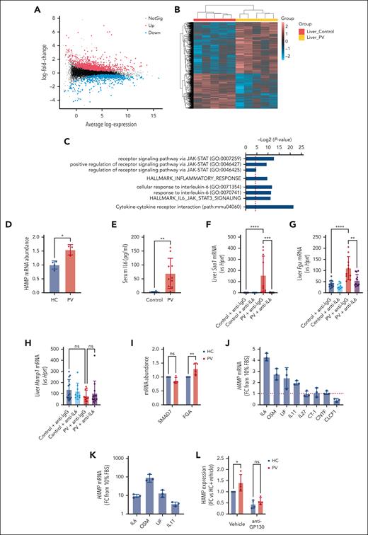 Inflammatory cytokines may upregulate hepcidin in PV. (A) Mean-difference plot showing the average log expression of each gene (x-axis) and their log-fold change between PV and control liver samples (y-axis). The DEGs are highlighted with points in red and blue indicating upregulated and downregulated genes, respectively (adjusted P value <.05). (B) Heatmap of the expression of all DEGs with hierarchical clustering in which expression values are standardized to have mean of 0 and standard deviation of 1 for each gene. (C) Bar chart depicting GO biological processes, MSigDB hallmark gene sets, or KEGG pathways relating to JAK-STAT signaling, inflammatory response, IL-6 responses, or cytokine-cytokine receptor interactions that are associated with upregulated genes in PV liver samples vs control. x-axis represents statistical significance of the enrichment, increasing from left to right. The red dotted line represents P = .05. (D) HAMP mRNA expression of HepG2 cells cultured in media supplemented with 2% plasma from HC donors or patients with PV; HC, n = 4; PV, n = 3. (E) Mouse serum IL-6; control, n = 8; PV, n = 10. (F-H) Liver Saa1 (F), Fga (G), and Hamp1 (H) relative to Hprt; control + anti–immunoglobulin G (IgG), n = 14; control + anti–IL-6, n = 9; PV + anti-IgG, n = 10; and PV + anti–IL-6, n = 13. (I) SMAD7 and FGA mRNA expression of HepG2 cells cultured in media supplemented with 2% plasma from HC donors or patients with PV; n = 4. (J-K) HAMP mRNA expression of HepG2 (J) or Huh7 (K) cells cultured in media supplemented with 10 ng/mL recombinant human IL-6–family cytokines; n = 3. The red line in panel J indicates HAMP expression in the absence of additional cytokines. (L) HAMP mRNA expression of HepG2 cells cultured in media supplemented with 2% plasma from HC donors or patients with PV with the addition of anti-GP130 antibodies or vehicle control (phosphate-buffered saline); n = 4. Unpaired 2-tailed t test with Welch correction for panels D-E, Kruskal-Wallis test for panels F-H, or two-way ANOVA with Šídák correction for multiple comparisons for panels I,L. ∗P < .05; ∗∗P < .01; ∗∗∗P < .001; ∗∗∗∗P < .0001. GO, gene ontology; OSM, oncostatin M; LIF, leukemia inhibitory factor; CT-1, cardiotrophin 1; CNTF, ciliary neurotrophic factor; CLCF1, cardiotrophin-like cytokine factor.
