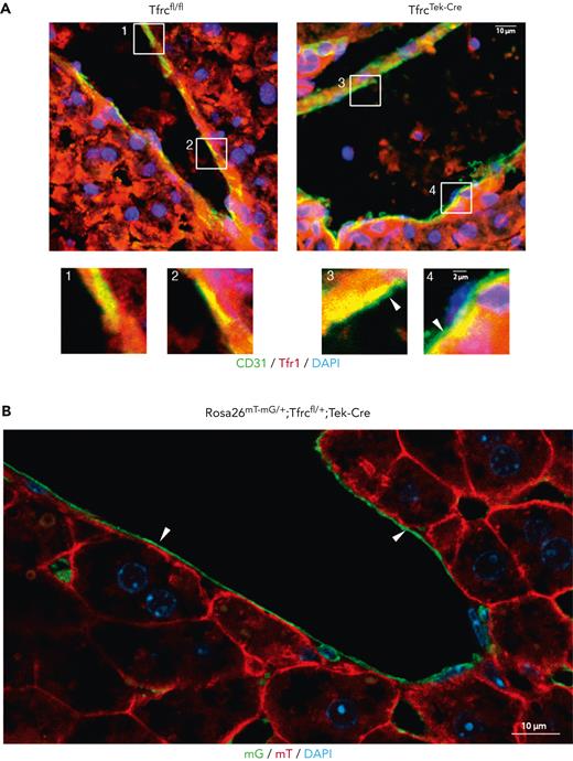 Validation of the LSECs Tfr1 knockout in the TfrcTek-Cremouse model. (A) Frozen liver slices from control Tfrcfl/fl (left) or TfrcTek-Cre mice (right) were processed for immunofluorescence and stained for Tfr1 using a Cy3-labeled secondary antibody (red) and for CD31 using an Alexa488-labeled secondary antibody (green). Overlapping areas of Tfr1 and CD31 expressions are shown in yellow. Nuclei were visualized using 4′,6-diamidino-2-phenylindole (DAPI) staining (blue). Areas in the highlighted rectangles are shown at a higher magnification (bottom). Arrows indicate exclusive CD31 expression in the LSEC lining. Scale bars, 10 μm (highlighted rectangles, bottom, scale bars, 2 μm). (B) Frozen liver slices from a Rosa26mT-mG/+;Tfrcfl/+;Tek-Cre reporter mouse were processed for confocal microscopy imaging for the expression of mT (red) and mG (green); the latter emerged following Cre-mediated recombination. The arrows indicate the LSEC lining. Scale bars, 10 μm.