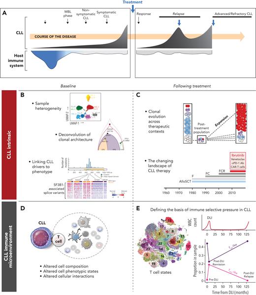 Insights into CLL afforded by single-cell analysis. (A) Schematic of a typical CLL disease course and conceptualization of the coevolution with host immunity. Thus far, single-cell analysis has been applied to evaluate the molecular features intrinsic to CLL cells at baseline (B) as well as after therapy (C). Likewise, single-cell analysis has been applied to evaluate the native state of the CLL immune microenvironment (D) as well as the dynamic changes in immune cell populations after immune therapies (E). WBC, white blood cell.