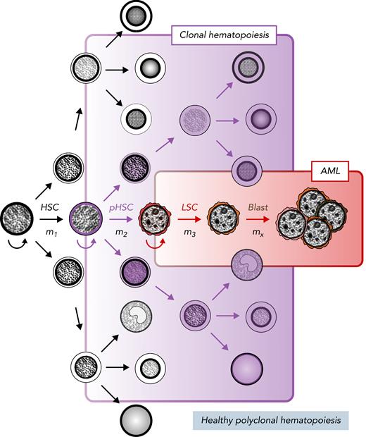 Stem cell model of normal and malignant hematopoiesis. Hematopoietic stem cells (HSCs) are capable of self-renewal (semicircular arrow) and reside at the apex of healthy polyclonal hematopoiesis (black). The acquisition of mutations in HSCs (m1) can create preleukemic HSCs (pHSCs; purple) that can drive clonal hematopoiesis (shaded purple). Clonal evolution through additional mutation acquisition (m2, 3, …x) or other molecular processes can further transform pHSCs into LSCs (red). These LSCs reside at the apex of the AML cellular hierarchy and are capable of (re)generating frank leukemia (brown).