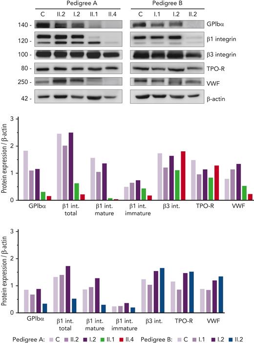 Immunoblotting of platelet lysates revealed severely reduced levels of GPIbα and glycosylated β1 integrin. Platelet lysates of controls, healthy relatives, and patients from both pedigrees were immunoblotted with anti-GPIbα, anti-β1 integrin, anti-β3 integrin, anti-TPO receptor, anti-VWF, and anti-β-actin as an internal control. Band intensities in blots were quantified by densitometric analysis using the ‘Image J’ software. Bar graphs represent each protein expression relative to β-actin. Impaired GPIbα and β1 integrin levels were observed in the proband from both pedigrees. VWF level was also reduced in pedigree A patients. VWF, von Willebrand factor.