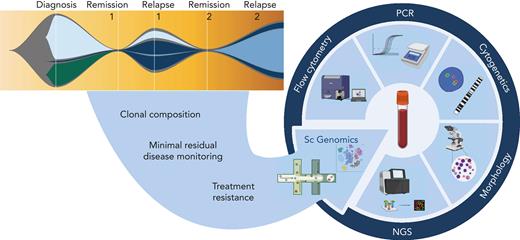 Potential translational role of single-cell genomics in hemato-oncology diagnostics. Complementing the current repertoire of tests applied at diagnosis, remission, and relapse, we anticipate that the addition of single-cell genomics techniques has the potential to delineate clonal composition, track rare populations through remission and relapse, and identify transcriptional signatures that predict treatment response or resistance. NGS, next-generation sequencing; PCR, polymerase chain reaction. Figure created with BioRender.com.