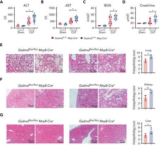 GSDMD deficiency in neutrophils increases multiorgan dysfunction during lethal sepsis. (A-G) Polymicrobial sepsis was induced in Gsdmdf+/f+MRP8-Cre+ and littermate WT control (Gsdmdf+/f+MRP8-Cre−) mice via CLP. Twelve hours after CLP, mice were euthanized to collect serum, lungs, kidneys, and liver. ALT (A), AST (B), BUN (C), and creatinine (D) were measured in the serum. Histopathological images of the lungs (E), kidneys (F), and liver (G) and their corresponding scores. t-test was used to compare the means between 2 groups. ∗P < .05; ∗∗P < .01. ALT, alanine transaminase; AST, aspartate aminotransferase; BUN, blood urea nitrogen.