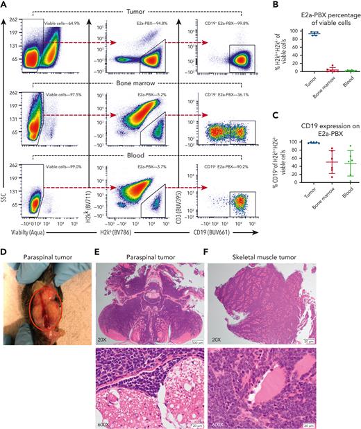 In mice receiving allogeneic HCT using PTCy and CAR T cells on day +5, E2a-PBX relapses uniquely occurred as CD19+extramedullary tumors with partial loss of CD19+on leukemia within hematopoietic organs. (A) Flow cytometric schema for a representative mouse. (Left) Viable cells were gated off singlets. (Center) From viable cells, H2kb+H2kk− E2a-PBX leukemia cells were gated and (right) assessed for CD19 expression. (B-C) E2a-PBX leukemia composed nearly all cells in the extramedullary tumors wherein it was uniformly CD19+. By contrast, E2a-PBX was only a small fraction of cells in hematopoietic organs wherein it was CD19− in a subset of cells. (D-F) Photograph and histopathology of paraspinal extramedullary tumors for the mouse in panel A with the histopathology and flow cytometric analyses all coming from different sections of the same tumor. (E) Cross section of vertebral column in the lumbosacral region, demonstrating effacement of paraspinal muscles by lymphoma. Higher magnification shows infiltration of paraspinal muscles by a uniform population of lymphoblasts and invasion of the spinal canal adjacent to spinal nerve roots. (F) Section of skeletal muscle severely infiltrated by a uniform population of lymphoblasts. Higher magnification demonstrates individual myofibers separated by a uniform population of neoplastic lymphoblasts.