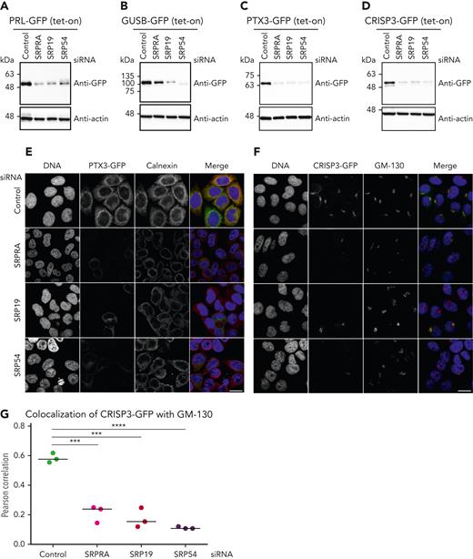 Maturation, processing, and targeting of newly identified SRP-dependent proteins (de novo expression). (A-D) Immunoblot analysis of HeLa cell lysates expressing tetracycline-induced PRL-GFP, GUSB-GFP, PTX-GFP, and CRISP-GFP. Cells were treated with control or SRP small interfering RNAs (siRNAs) and processed for immunoblotting with the indicated antibodies. Experiment performed in triplicate. (E) Confocal microscopy images of HeLa cells depleted of endogenous SRP proteins by siRNA and stably expressing PTX3-GFP. Cells were immunostained with an anticalnexin antibody, and DNA was visualized with 4′,6-diamidino-2-phenylindole (DAPI). Scale bar, 10 μm. Experiment performed in triplicate. (F) Confocal images of HeLa cells depleted of endogenous SRPs by siRNA and stably expressing CRISP3-GFP. Cells were immunostained with an anti-GM130 antibody and DNA was visualized with DAPI. Scale bar, 10 μm. Experiment performed in triplicate. (G) Quantification of the colocalization of CRISP3-GFP with GM130. Unpaired t test, 2-tailed (P < .0001 and P < .005). Quantitative analysis represents 3 independent experiments.