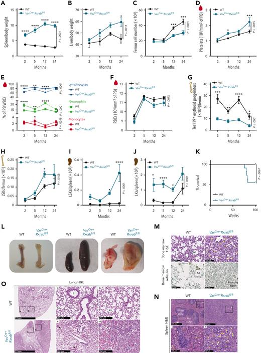 VavCre+Rxrabfl/flmice develop lethal myeloproliferative disorders. (A-C) Organ weight and counts of 2-, 5-, 12-, and 24-month-old WT and VavCre+Rxrabfl/fl mice. (A-B) Spleen and liver weigh/body weight ratios. (C) BM cellularity per femur. (D-F) Hemogram data of 2-, 5-, 12-, and 24-month-old WT and VavCre+Rxrabfl/fl mice. (D) Mean platelet counts. (E) Percentage of lymphocytes, neutrophils, and monocytes among white blood cells (WBCs). (F) Total red blood cells (RBCs). (G-J) Flow cytometry of femur and spleen homogenates from 2-, 5-, 12-, and 24-month-old WT and VavCre+Rxrabfl/fl mice. (G) Absolute numbers of erythroid progenitors (CD45−Ter119+ cells) per femur. (H) Absolute numbers of LSKs per femur. (I-J) Absolute numbers of spleen LSKs and LKs. (K) Kaplan-Meier survival plots for WT and VavCre+Rxrabfl/fl mice (n = 11-13 per genotype). (L) Representative images of femurs, spleens, and lungs of 24-month-old WT and VavCre+Rxrabfl/fl mice. (M-N) Representative images of hematoxylin and eosin (H&E)– and reticulin-stained femur sections, and of H&E-stained spleen sections from 24-month-old WT and VavCre+Rxrabfl/fl mice; yellow arrows indicate megakaryocytes. Scale bars: 500 μm (N, upper panels), 100 μm (M, upper panels; N, bottom panels), or 50 μm (M, bottom panels). (O) Representative images of H&E-stained lungs from 24-month-old WT and VavCre+Rxrabfl/fl mice; black arrows indicate alveolar hemorrhage. Scale bars: 2.5 mm (left panels) or 250 μm (middle and right panels). Data are presented as mean ± SEM: (A-F) n = 7 to 17 mice, pooled from up to 3 independent experiments per age group and genotype; (G) n = 3 to 13 mice, pooled from up to 2 independent experiments per age group and genotype; (H) n = 4 to 24 mice, pooled from up to 3 independent experiments per age group and genotype; (I) n = 5 to 12, pooled from up to 2 independent experiments per age and genotype (spleen); (J) n = 5 to 11 mice, pooled from up to 2 independent experiments per age and genotype. Significance was determined by 2-way analysis of variance followed by the Sidak multiple comparisons test (age-paired mice) (A-J) or log-rank (Mantel-Cox) test (K), and is represented as follows: ∗P ≤ .05, ∗∗P ≤ .01, ∗∗∗P ≤ .001, and ∗∗∗∗P ≤ .0001. A, alveoli; Ad, adipocytes; AS, alveolar sac; B, bronchiole.