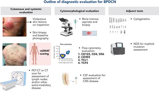 Diagnostic evaluation for BPDCN. CT, computer aided tomography; mSWAT, modified severity weighted assessment tool; PET, positron emission tomography.