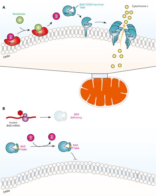 Dependence of venetoclax response on BAX and development of venetoclax resistance through BAX mutations. (A) Venetoclax, by engaging BCL2 as an alternative ligand, releases proapoptotic BH3-only proteins from BCL2, which then activates apoptosis effector proteins such as BAX. BAX is found predominantly in the cytosol with its COOH-terminal transmembrane region (TMR) sequestered within its hydrophobic pocket. Once activated, BAX releases its TMR to be inserted into the OMM, where BAX oligomerizes to permeabilize the OMM and induce release of cytochrome c. (B) Acquired frameshift/nonsense mutations in BAX reduce its protein expression while inactivating missense mutations in BAX such as P168A compromises its effector functions by preventing BAX TMR release and insertion into the OMM. mRNA, messenger RNA.