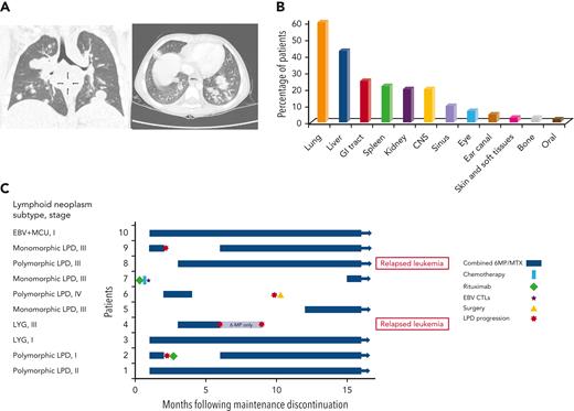 IA lymphoid neoplasms after ALL. (A) Coronal (left) and axial (right) chest CT scans of a 4-year-old boy with persistent fever and cough during ALL maintenance therapy, demonstrating multiple nodular pulmonary lesions, subsequently diagnosed with EBV-positive DBCL. (B) Percentage of patients with involvement of different extranodal sites (data available for 60 patients). (C) A swimmer’s plot summarizing treatment and outcome of 10 patients for whom maintenance therapy had been reinitiated after achieving remission from lymphoid neoplasm. Patient numbers, lymphoid neoplasm subtype, and stage are depicted on the left. CT, computed tomography; CTL, cytotoxic T lymphocytes; LYG, lymphomatoid granulomatosis; MCU, mucocutaneous ulcer; MTX, methotrexate; 6MP, mercaptopurine.