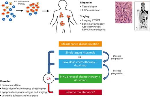 Suggestions for the clinical management of maintenance-associated lymphoid neoplasms. CR, complete remission; CSF, cerebrospinal fluid; PET-CT, positron emission tomography-computed tomography.