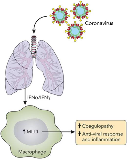 MLL1 is central to macrophage activation. A summary of the work by Sharma et al,1 depicting increased MLL1 expression in macrophages due to IFNs produced as a result of pulmonary coronavirus infection. MLL1 expression is a key factor in macrophage activation, causing coagulopathy and inflammation and inducing an antiviral response. Professional illustration by Patrick Lane, ScEYEnce Studios.