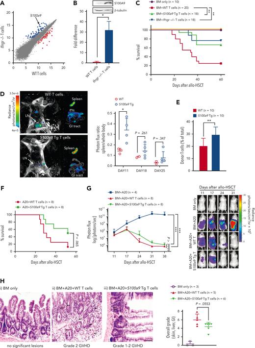 S100a9-overexpressing T cells separate GVHD from GVL, increasing T-cell retention in the spleen. (A) WT or Ifngr1−/− CD4+CD25− T cells obtained from C57BL/6 were cocultured with irradiated (2000 rad) whole splenocytes obtained from Balb/c as alloantigen stimulators. After 6 days of coculture, total RNA was purified from CD4+CD25+ cells sorted by flow cytometry. RNA profiling analyses were performed using the Mouse Genome 430 2.0 array. Shown are up- (blue dots) or down-(red dots) regulated genes in Ifngr1−/− T cells. (B) Expression of S100a9 mRNA and S100A9 protein was determined using real-time PCR and western blotting, respectively. (C) Allo-HSCT was performed as follows; 5 × 106 TCD-BM (CD45.1+ WT) and 5 × 105 T cells (CD45.2+ WT, Ifngr1−/−, or S100a9-Tg) obtained from B6 mice were transplanted on day 0 into lethally irradiated (900 cGy on day −1) Balb/c allogeneic recipient mice. The TCD-BM only group serves as no GVHD control. The mice were monitored for survival. A pool of 3 independent experiments is shown. (D) In vivo BLI was performed to track T cells after allo-HSCT. The representative BLI images are obtained from dissected mice transplanted with WT (upper) and S100a9-overexpressing T cells (lower) on day 11 after allo-HSCT. Photon flux (photons/s) was measured from the spleen, GI tract, and the rest of the whole body. The ratio of signal intensities (photons/s per cm2 per sr) from the spleen and the rest of the body were compared (right panel). (E) The percent donor T cells in the spleens of recipient mice transplanted with WT or S100a9-overexpressing T cells was measured on day 21 after allo-HSCT. The donor T cells were determined by H2-Kd− and CD45.2+. (F-H) Allo-HSCT was performed as follows; luciferase/RFP-expressing A20 leukemia cells (1 × 105) were injected on the day of TCD-BM cell infusion (day 0), followed by delayed donor lymphocyte infusion (DLI; 2 × 106 T cells) on day 11. The leukemia burden was measured weekly using BLI. A pool of 2 independent experiments. (F) Survival rate and (G) leukemia burden. Representative images of each group from days 11 to 31 are shown. (H) Representative images of the small intestine of each group on day 21 after allo-HSCT. (i, TCD-BM only; ii, TCD-BM+A20+WT T cells; and iii, TCD-BM+A20+S100a9-overexpressing T cells). TCD-BM only group has no significant lesions. The arrows indicate crypt apoptosis, luminal debris, and crypt dropout. The scale bar represents 100 μm. Overall histological grades on day 21 after allo-HSCT (right panel). ∗P < .05, ∗∗P < .01, and ∗∗∗P < .001. All error bars are presented as mean ± standard deviation. BLI, bioluminescence imaging; GI, gastrointestinal; mRNA, messenger RNA; PCR, polymerase chain reaction; TCD, T-cell depleted.