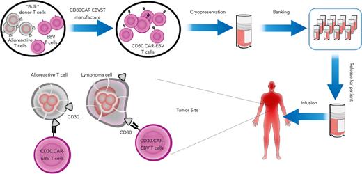 Development and clinical testing of a bank of CD30.CAR-EBVSTs. Allogeneic CD30.CAR transduced EBVSTs (CD30.CAR-EBVSTs) will kill (1) recipient activated alloreactive T cells that upregulate CD30 upon activation and (2) CD30-expressing lymphoma cells. EBVSTs will not cause GVHD.