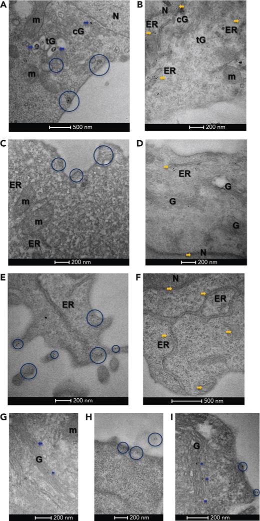 Immuno-electron microscopy of CALR. (A) In BaF3 cells, Flag-tagged CALR-del52 localized in both the cis-Golgi (cG) and trans-Golgi (tG) compartments (blue arrows), as well as vesicles distributed between the trans-Golgi network and the plasma membrane (blue circles), suggesting it follows the secretory pathway to the cell surface. (B) By contrast, Flag-tagged CALR WT predominantly localized in the ER and nuclear heterochromatin (yellow arrows) and was less frequent in the Golgi network (cG, tG). (C) In cytokine-independent, proliferating clustered regularly interspaced short palindromic repeats (CRISPR)-modified BaF3 TpoR Calrmut cells, which expressed both CALR-del52 as well as endogenous CALR, anti–N-terminus labeling was frequently observed at the plasma membrane (blue circles), suggesting CALR secretion is maintained in this cell line. (D) In control CRISPR BaF3 TpoR Calrwt cells, endogenous CALR localized mostly in the nucleus (N), perinuclear space, ER (yellow arrows), and the Golgi (G) network. (E) In primary Calr del52/WT KI mouse bone marrow cells, N-terminus–labeled CALR could be detected within the Golgi network (not shown), as well as at the plasma membrane (blue circles), suggesting secretion of CALR is maintained in these cells. (F) In control CalrWT/WT mouse bone marrow cells, endogenous CALR was mostly localized at the ER and the nucleus (N). When using a mutant-specific anti-CALR antibody labeling could be detected in the Golgi network of CRISPR-modified BaF3 TpoR Calrmut cells (G) (blue arrows) but also at the plasma membrane (H), including associated with ectosomes (blue circles). (I) Similarly, the mutant-specific antibody identified CALR-del52 in the secretory pathway of Calrdel52/WT KI mouse bone marrow cells (blue arrows and circles). Gold particle size is on average 0.8 nm in panel A and 6 or 10 nm in panels B to I. Scale bars represent 500 nm (A,F) and 200 nm (B-E,G-I). m, mitochondria.