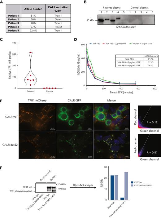 sTFR1 is a carrier protein for mutant CALR. (A) Allele burden and mutation profile of patients included in this study the analysis. (B) Identification of partners of plasmatic mutant CALR. Plasma from 5 patients with mutated CALR and 5 healthy controls was isolated by IP with biotinylated antimutant CALR antibody. Immunoblot shows the presence of mutant CALR in the IP product detected with a different antimutant CALR antibody. The IP product was analyzed by nontargeted MS to identify interacting partners. (C) Truncated violin plot of relative sTFR1 amount found coimmunoprecipitating with plasma CALR-del52. Negative control corresponds to the IP product after anti–mutant CALR IP to control for nonspecific binding to anti–mutant CALR antibody. (D) Stability study of rhCALR-del52 in medium with 10% fetal bovine serum (FBS), with or without addition of 2 or 4 μg/mL of rhTFRC. rhCALR-del52 mutant in different media was maintained at 37°C for various lengths of time and measured by ELISA before analysis using a 1-phase decay model (Prism6) to determine the averaged half-life. Values represent mean of triplicate ± SD. (E) Representative confocal microscopy pictures of HEK293T cotransfected with either CALR WT or CALR-del52 fused to green fluorescent protein at the C-terminus and TFR1 fused to mCherry at its C-terminus. Scale bars represent 10 μm. Microscopy analysis shows colocalization between CALR-del52 and TFR1 in subcellular compartments with high correlation between the 2 constructs. (F) IP and glycosylation profile analysis of endogenous TFR1 from UT-7/Tpo or UT-7/Tpo CRISPR CALR-del52. Western blot shows the TFR1 forms analyzed by MS. Data represent the percentage of peptide-spectrum match of immature N-glycans (high mannose) present on residue Asn251 in the cleaved or full form of TFR1.