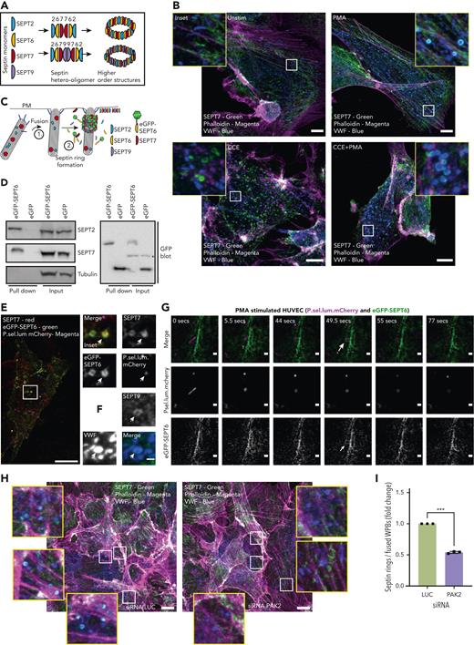 Septin rings are recruited to WPBs post fusion in an actin-independent but PAK2-dependent process. (A) To form higher-order structures such as rings, septin (SEPT) monomers from different subfamilies (eg, SEPT2/6/7/9) must form hetero-oligomers (6mers or 8mers). (B) SEPT7 is recruited to WPBs following stimulation. IF analyses of SEPT7 (green), VWF (blue), and actin (magenta) in HUVEC cultures stimulated with the presence or absence 100 ng/mL PMA and/or 1 μM CCE. Scale bar, 10 μm. (C) Schematic representation of the approach used to image septins in live endothelial cells. GFP-tagged SEPT6 interacts with endogenous SEPT7 upon ring formation. (D) GFP pull-down of control GFP and eGFP-SEPT6−transfected cells detects the association of the eGFP-SEPT6 transgene product with endogenous SEPT2 and SEPT7. Beta tubulin was absent in both eGFP control and eGFP-SEPT6 pull-down samples. ∗Cross-reactivity. (E) Confocal microscopy of fixed HUVECs transfected with P.sel.lum.mCherry (magenta) and eGFP-SEPT6 (green) and probed for SEPT7 (red) by IF. Images show that eGFP-SEPT6 is incorporated into rings that are positive for SEPT7 staining. Scale bars, 10 μm. (F) SEPT9 is localized to fused WPBs following stimulation with PMA. (G) Live cell imaging of PMA (100 ng/mL)−stimulated HUVECs indicates that SEPT6-eGFP rings form post fusion. Brightness and contrast increased for clarity. †WPB fusion. ∗Septin ring formation; 0.5- to 6-μm Z stacks acquired every 5 seconds for 10 minutes. Scale bars, 1 μm. (H) HUVECs were transfected with LUC control (left panel) or PAK2-targeted siRNA (right panel) and probed for SEPT7 (green), VWF (blue), and actin (magenta). Scale bar, 10 μm. (I) Quantification of the number of SEPT7 associated with VWF as a proportion of the total number of rounded (fused) WPBs. A total of 15 images per condition from three independent experiments (ratio paired t test). ∗∗∗P < .005.
