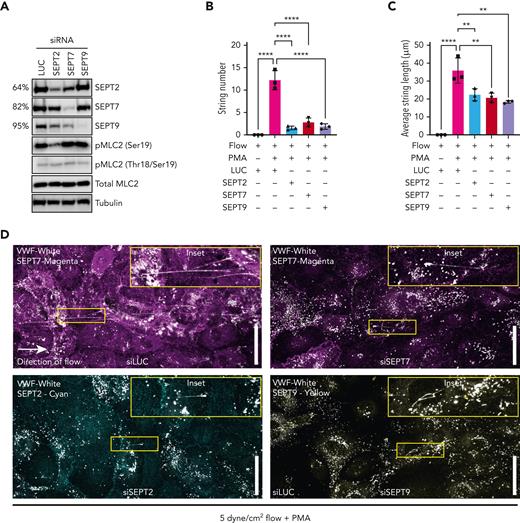 Septin depletion reduces efficiency of VWF string release. HUVECs were depleted of SEPT2, SEPT7, and SEPT9 using siRNA and VWF string secretion under flow assessed by immunofluorescence. (A) Western blotting confirmed effective target protein depletion in HUVECs treated with 300 pM SEPT2/7/ siRNA. MLC2 phosphorylation at ser19 was reduced in SEPT2 KD cells. (B) Depletion of SEPT/7/9 inhibited VWF string formation in HUVECs exposed to 5 dynes/cm2. (C) On average, SEPT2/7/9 depletion resulted in shorter VWF strings bound to the endothelial cell surface. Data presented as mean from each independent experiment (n = 3). One-way ANOVA with Tukey multiple comparison test. (D) Confocal microscopy images (0.5 μm Z stacks) were acquired using identical settings. Scale bar, 50 μm. Representative immunofluorescence images of septin and VWF staining in siLUC (top left panel), siSEPT7 (top right panel), siSEPT2 (bottom left panel), and siSEPT9 (bottom right panel) treated HUVECs.