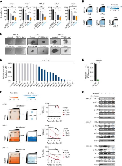 Concomitant PP2A activation and BCL2 inhibition significantly decreases the clonogenic potential and proliferation of primary AML cells ex vivo. (A) Bar graphs show the percentage of colonies grown after exposure to different treatments. Data were analyzed by one-way ANOVA and Tukey post hoc test analyses; ∗P < .05, ∗∗P < .01, ∗∗∗P < .001. (B) Heatmaps show the CI values of FTY720 plus venetoclax in 5 primary AML samples. (C) Representative images of colonies grown upon treatment exposure. Scale bars: 400 μM. Bar graphs show reduction of venetoclax (D) or A-1331852 (BCL-XL inhibitor) (E) IC50 values upon combination with FTY720 in 21 distinct primary AML samples at diagnosis. (F) Heatmap representations of viability percentages and CI values, along with cell viability curves of FTY720 combined with venetoclax at increasing concentrations in cells from patients with AML (AML-6, AML-7, and AML-11) (60 hours of treatment). (G) After combo treatment (36 hours), MCL1, Ser70p-BCL2, and Thr202/Tyr204p-ERK levels were significant decreased in therapy-responsive samples (AML-7 and AML-11). ANOVA, analysis of variance; ns, not statistically different.