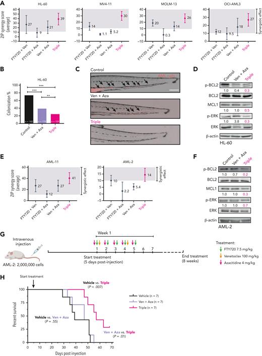 PP2A activation further improves the effectiveness of venetoclax plus azacitidine therapy in AML. (A) Multidrug synergy graphs show the average ZIP synergy score for double and triple combinations between FTY720, venetoclax, and azacitidine. Analyses were performed with the SynergyFinder Plus webtool. Synergy scores >10 (gray boxes) were considered synergistic. (B) Colonization potential of HL-60 cells in zebrafish xenograft models upon treatment with control, venetoclax plus azacitidine, or the triple therapy. Experiments were done in triplicate; number of embryos used is indicated as “n.” Data were analyzed by χ2 tests; ∗∗P < .01, ∗∗∗P < .001. (C) Representative images of HL-60 invading cells throughout the tail of zebrafish xenograft embryos at 72 hpi upon treatment with control, venetoclax plus azacitidine, or the triple therapy. AML cells were tracked as red-emitting fluorescent cells. Arrows show migrating HL-60 cells. Scale bar: 0.25 mm. (D) Western blot analyses of Ser70p-BCL2, BCL2, MCL1, Thr202/Tyr204p-ERK, and ERK protein expression levels in HL-60 cells after 24 hours of treatment with control vehicle, venetoclax plus azacitidine, or the triple combination. Only upon treatment with the triple combination were the levels of all 3 proteins p-BCL2, MCL1, and p-ERK significantly decreased. (E) Multidrug synergy graphs show the average ZIP score for double and triple combinations between FTY720, venetoclax, and azacitidine in 2 AML primary samples. Analyses were performed with the SynergyFinder Plus webtool. Synergy scores >10 (gray boxes) were considered synergistic. (F) Western blot analyses of Ser70p-BCL2, BCL2, MCL1, Thr202/Tyr204p-ERK, and ERK protein expression levels in AML-2 cells after 36 hours of treatment with venetoclax plus azacitidine or the triple combination. Only upon triple treatment was the expression levels of MCL1, Ser70p-BCL2, and Thr202/Tyr204p-ERK significantly decreased. (G) NSG mice were injected intravenously with AML-2 primary cells. Vehicle or double or triple-combination treatments were administrated by oral gavage starting 5 days postinjection. (H) Survival curve of an aggressive AML PDX model in NSG mice treated with vehicle, venetoclax plus azacitidine, or FTY720, venetoclax, and azacitidine combination (n = 7 mice per group). Triple-combination treatment induced a statistically significant increase in OS in treated mice compared with control animals (median OS, 57 vs 39 days; P = .007), or animals treated with venetoclax plus azacitidine (median OS, 47 vs 57 days; P = .01). Data were analyzed by the log-rank (Mantel-Cox) test. ZIP, zero interaction potency.