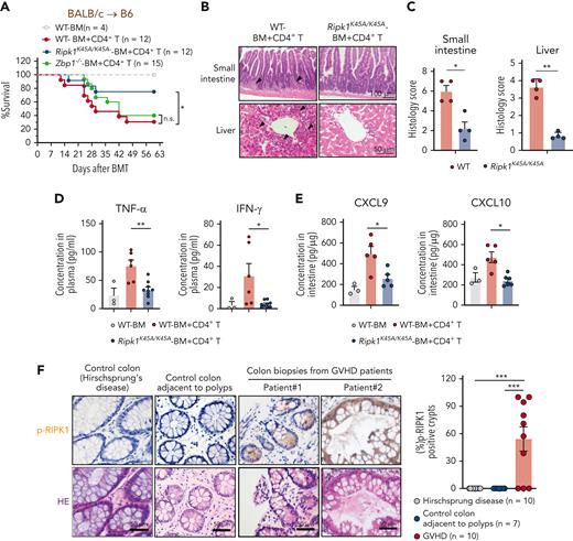 RIPK1 activates RIPK3 signaling in IECs during GVHD. (A-E) The lethally irradiated WT, Ripk1K45A/K45A, and Zbp1−/− B6 recipients (BALB/c→B6) received BALB/c TCD BM cells with or without CD4+ T cells. (A) Survival of mice after allo-HCT. (B-C) Histology analysis of small intestine and liver samples obtained from WT and Ripk1K45A/K45A B6 recipients on day 17 after allo-HCT. Representative H&E images (B) and quantification of pathology scores (C). Bar in small intestine represents 100 μm. Bar in liver represents 50 μm. Black arrows indicate areas of inflammatory cell infiltration or cell damage. (D) Levels of TNF-α and IFN-γ in serum from WT and Ripk1K45A/K45A B6 recipients on day 17 after allo-HCT. (E) ELISA analysis of CXCL9 and CXCL10 proteins in the small intestine from WT and Ripk1K45A/K45A B6 recipients on day 17 after allo-HCT. (F) Sections of 10 colon biopsies from patients with GVHD involved in the GI tract after allo-HCT, 10 control colon samples (from patients with Hirschsprung's disease) and 7 control colon samples adjacent to polyps were stained with an anti–p-RIPK1 antibody. Shown are representative images of IHC staining with anti–p-RIPK1 antibody and H&E staining from the control colon sample and 2 biopsies of patients with GVHD (left panel), and quantification of p-RIPK1 positive crypts in each sample (right panel). Bars represent 50 μm. Data shown are representative of 2 or 3 independent experiments. Data are shown as the mean ± SD (D-F), histology scores are shown as the mean ± SEM (C). ∗P < .05; ∗∗P < .01; ∗∗∗P < .001. Survival comparisons were evaluated by log-rank test (A). Multiple comparisons were evaluated by one-way ANOVA (D-F), two-group comparisons used unpaired t tests (two-tailed) (C). ANOVA, analysis of variance; ELISA, enzyme-linked immunosorbent assay analysis; IHC, immunohistochemistry; SD, standard deviation; SEM, standard error of the mean.