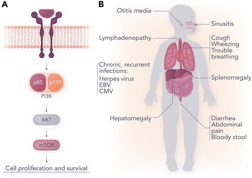 (A) Phosphatidylinositol-3-kinase (PI3K)/protein kinase B (AKT)/mammalian target of rapamycin (mTOR) signaling. (B) Clinical manifestations of APDS. Professional illustration by Somersault18:24.