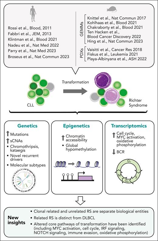 New understanding of RS. Insights into the biology of RS gained by recent large-scale studies profiling the genetic, transcriptomic, and epigenetic features of RS, and by the generation of mouse GEMM and PDX models highly reflective of human RS. GEMM, genetically engineered mouse model; PDX, patient-derived xenograft.
