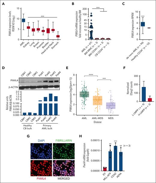 PIWIL4 is overexpressed in most patients with AML and AML LSCs. (A) PIWIL4 messenger RNA (mRNA) expression in types of cancer from The Cancer Genome Atlas (TCGA) data set. The boxplot indicates median expression and range of expression.26 (B) qRT-PCR mRNA expression of PIWIL4 in patients with AML, bone marrow mononuclear cells (BMNCs) and CD34+ BM and cord blood CD34+ (CB CD34+) HSPCs. Dots indicate biological replicates; horizontal bars represent median expression. (C) mRNA expression of PIWIL4 in patients with AML vs healthy CD34+ BM HSPCs from the Vizome RNA-seq data set.27 (D) Upper panel: PIWIL4 protein levels vs β-actin as loading control in independent biological replicates of cytogenetically normal (CN) patients with AML and healthy bulk CB. Lower panel: densitometry analysis of PIWIL4 protein expression relative to β-actin protein levels, analyzed using ImageJ. (E) RNA-seq mRNA expression PIWIL4 in de novo AML, secondary AML (sAML), and MDS. Dots indicate individual patients and the boxplot indicates median expression and range of expression. (F) PIWIL4 expression in lymphoid-myeloid primed multipotent progenitors (H-LMPPs vs L-LMPPs) derived from functionally validated, healthy individuals vs patients with leukemia patient. (G) Localization of PIWIL4 protein in AML cell line, NB-4. Nucleus was stained with 4′,6-diamidino-2-phenylindole (DAPI) and nucleolus with fibrillarin. The size bar indicates 20 μm distance. (H) Fold increase in Piwil4 mRNA expression in murine HSPCs transduced with AML-specific oncogenes (MLL-AF9, Cdx2, and AML1-ETO9A) vs empty vector control, 72 hours after transduction. “n” indicates number of independent experiments.