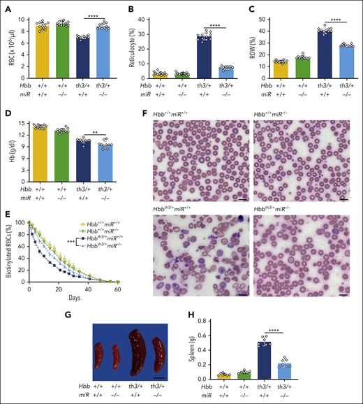 Ablation of miR-144/451 alleviates β-thalassemia in mice. β-thalassemic (Hbbth3/+) and miR-144/451−/− (miR−/−) mice were intercrossed and analyzed. (A-D) Erythroid indices (y-axis) of 8-week-old mice according to the genotype (x-axis). n = 12 mice for each genotype. (E) RBC survival. RBCs in 8-week-old mice were biotinylated at time 0. Loss of biotin-labeled RBCs over time was quantified via streptavidin labeling and flow cytometry. Differences between Hbbth3/+miR+/+ and Hbbth3/+miR−/− mice were significant at all time points at which measurements were made between days 2 and 34 (Benjamini-Hochberg false discovery rate–adjusted P value = .002-.02). (F) Representative images of blood smears (Giemsa stain) from mice with the indicated genotypes. Images were obtained using an Eclipse Ni microscope and a 40× objective lens; bars represent 5 μm. (G) Representative images of spleens from mice with the indicated genotypes. Bar represents 1 cm. (H) Summary of spleen weights. n = 7 mice for each genotype. All bar charts show data as mean values ± standard deviation (SD); ∗∗∗∗P <.0001; ∗∗∗P <.001; ∗∗P <.01.