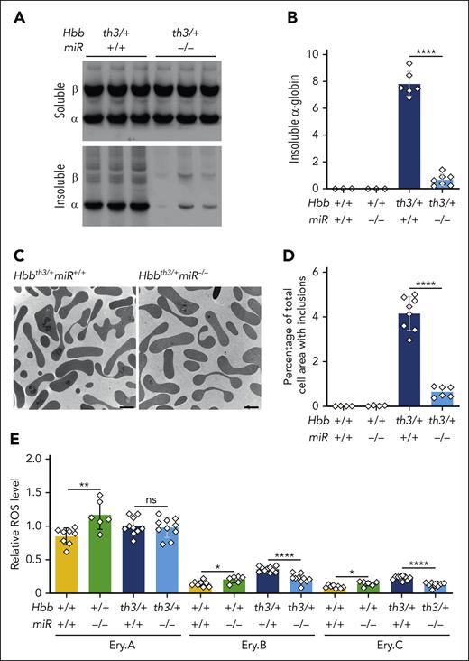 miR-144/451 disruption reduces the accumulation of insoluble α-globin and reactive oxygen species (ROS) in β-thalassemia. (A) Soluble and insoluble RBC globin proteins. Equal volumes of RBCs (normalized by hematocrit) were lysed, centrifuged to separate insoluble and soluble proteins, fractionated by Triton–acetic acid–urea (TAU) gel electrophoresis to resolve α- and β-globin proteins, and stained with Coomassie brilliant blue. (B) Results of multiple experiments performed as described in panel A. The y-axis represents the relative levels of insoluble α-globin, as measured via automated image analysis of TAU gels, and expressed in arbitrary units. n = 3 to 6 mice for each genotype. (C) Thiazole orange–stained reticulocytes were isolated by fluorescence-activated cell sorting to a purity of ∼95%, then analyzed for electron-dense α-globin precipitates by transmission electron microscopy using an FEI Tecnai 200Kv FEG Transmission Electron Microscope with an ATM XR41 digital camera. Representative micrographs show reticulocytes from mice with the indicated genotypes. Bars represent 2 μm. (D) Areas of α-globin inclusions in reticulocytes (y-axis) determined by automated image analysis of electron micrographs prepared in the same manner as those in panel C. n = 4 to 8 mice for each genotype. Approximately 200 cells from each mouse were analyzed. (E) Flow cytometry quantification of ROS, determined by 2′, 7′-dichlorodihydrofluorescein diacetate staining of bone marrow erythroblasts. Ery.A, Ery.B, and Ery.C represent distinct developmental stages defined by the expression of erythroid maturation markers and cell size (supplemental Figure 2). n = 6 to 10 mice for each genotype. Bar charts show data as mean values ± SD; ∗∗∗∗P < .0001; ∗∗P < .01; ∗P < .05; ns, not significant.