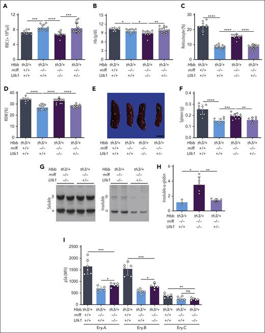 Ablation of Ulk1 reduces the beneficial effects of miR-144/451 disruption in β-thalassemia. WT C57BL/6 mice (expressing CD45.1) received transplantation with Lin− E14.5 fetal liver HSPCs with the indicated genotypes and analyzed 8 weeks after transplantation. (A-D) Erythroid indices (y-axis) according to the genotype (x-axis). n = 10 to 12 mice for each genotype. (E) Representative spleens at 8 weeks after transplantation. Bars represent 0.5 cm. (F) Summary of spleen weights. n = between 8 and 11 mice for each genotype. (G) TAU gels stained with Coomassie brilliant blue showing soluble and insoluble α- and β-globin proteins in RBC lysates. (H) Relative insoluble α-globin levels in RBCs as determined by TAU gel analysis, performed as described in panel G, and quantified using automated image analysis. n = 3 to 5 mice for each genotype. (I) Flow cytometry quantification of S6 phosphorylation in maturation stage–matched bone marrow erythroblasts. n = 5 to 6 mice for each genotype. Bar charts show the data as mean values ± SD; ∗∗∗∗P < .0001; ∗∗∗P < .001; ∗∗P < .01; ∗P < .05.