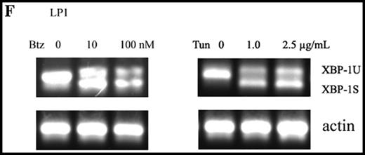 The role of XBP1 in UPR-mediated Mcl-1 expression. (A-F) RT-PCR analysis of XBP1 splicing in different MM cell lines. The MM cell lines OPM2, MMS1, U266, 5T33vt, RPMI-8226, and LP1 were treated with bortezomib and tunicamycin for 24 hours at varying doses. RNA isolation and RT-PCR were performed as described in “Methods.” In the human MM cell lines OPM2, MMS1, U266, RPMI-8226, and LP1, the 210- and 184-bp DNA fragments correspond to unspliced and spliced human XBP1 mRNAs, respectively. In 5T33vt cells, the 343- and 327-bp DNA fragments correspond to unspliced and spliced mouse Xbp1 mRNAs, respectively.