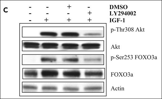 IGF-1 down-regulates Bim expression in the human Karpas707 cells through the PI-3K and p42/44 MAPK pathways. (C) Cells were starved 24 hours, pretreated with LY294002 (1 hour of preincubation; 10 μM) and stimulated with IGF-1 for 10 minutes. Next, the levels of p-Akt, tot-Akt, p-FoxO3a, and tot-FoxO3a were analyzed by Western blot. To confirm equal loading levels of actin were determined.