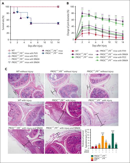 SR604 significantly improves survival and ameliorates inflammation of knee-joint injury of humanized hemophilic mice. (A) Survival rates after injuries. (B) The change of the knee-joint diameter of mice calculated as percentage of the value before injury. Knee diameters were measured with an electronic caliper before needle injury and every other day after the injury; n = 6 mice per group. ∗∗P < .01. (C) Microscopic images of hematoxylin and eosin–stained knee joint tissues (original magnification ×20). Marked areas show inflammation and proliferation of the synovial and stromal linings. Bar graph represents quantification of the thickness of the inflamed and proliferated synovial and stromal linings; n = 3 mice per group. ∗P < .05; ∗∗∗P < .001.