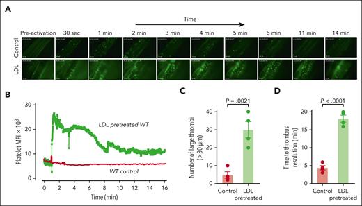 LDL enhances microvascular thrombosis induced by calcium ionophore in WT C57BL/6 mice. WT mice (aged 3-4 weeks) were injected with platelets that were isolated from WT donors and fluorescently labeled with calcein AM ex vivo. Their mesenteric vessels were exposed and topically treated with calcium ionophore to induce VWF secretion. The dynamics of platelet VWF thrombus formation and resolution in mesenteric vessels were monitored and quantified. For the LDL-pretreated group, mice received 100 mg/kg of purified human LDL through tail-vein injection 10 minutes before calcium ionophore treatment. (A) Sequential images taken at the indicated times after the application of calcium ionophore. Images taken at similar times from the control and LDL-pretreated WT mice are aligned. Original magnification ×200. (B) Mean fluorescence intensity (MFI) of platelet thrombi was quantified for each frame of the recorded video and plotted against time. (C) Platelet thrombi >30 μm in diameter were quantified. (D) Time to thrombus resolution was quantified. Upon calcium ionophore stimulation, platelets immediately began to accumulate on the vessel wall. Adhesion was monitored, and the time required for the fluorescence value to return to baseline was measured. LDL treatment significantly prolonged the time required for platelet adhesion to return to baseline. The data were analyzed using Student t test; the P values are indicated.