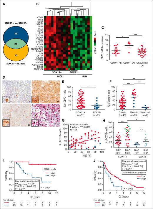 CD70 overexpression in nodal MCLs. (A) Venn diagram showing the overlap between the NanoString-based statistically significant upregulated genes in SOX11+ compared with SOX11− nodal MCLs (50 genes; blue circle) and SOX11+ compared with RLNs (54 genes; yellow circle). (B) Heatmap showing the scaled expression levels of common 24 significant upregulated genes in SOX11+ compared with SOX11− nodal MCLs and RLNs. Red represents increased expression and green reduced expression. Genes with an adjusted P value (Q-value) < .15 were considered. (C) CD70 mRNA expression levels in unpurified lymph node MCL samples (unpurified LN; n = 34), CD19+ purified cells from LN samples (CD19+ LN; n = 4) and peripheral blood samples (CD19+ PB; n = 15) (GSE70910). ∗q value < .05, ∗∗∗q value < .001. (D) Representative histological sections from (i) an RLN sample, (ii) SOX11+, and (iii) SOX11− nodal MCL biopsy, stained with specific anti-human CD70 antibody (×100). A double IHC staining with anti-human CD70 (brown) and (iv) anti-human cyclin D1 (red) antibodies (×100) was performed in the same SOX11− nodal MCL case as in (iii) to confirm the expression of CD70 by tumor cells (black arrows). Pictures contain insets with magnification (×400). (E) IHC quantifications of CD70+ cells in our series of SOX11+ (n = 51) and SOX11− (n = 13) nodal MCL primary samples. (F) IHC quantification of CD70 expression in nodal samples according to classic, blastoid/pleomorphic, or small cell MCL variants. (G) Positive correlation between CD70+ and Ki67+ cells, quantified by IHC in our series of nodal MCL. SOX11+ MCL are indicated in red, whereas SOX11− MCLs are in blue. Graphs show Pearson correlation coefficient (r), P value, and number of cases analyzed (N). (H) IHC quantification of CD70 expression in nodal MCL samples according to high (Ki67 >30%) and low (Ki67 ≤30%) proliferation rates in our series of SOX11+ (red) and SOX11− (blue) primary MCL cases. MCL cases diagnosed as blastoid/pleomorphic cytological variant are highlighted in green. The significance of differences was determined by independent samples Student t test: ∗P < .05, ∗∗P < .01, ∗∗∗P < .001. (I) Kaplan-Meier curve and Cox regression showing the association of CD70+ cells, quantified by IHC using our series of SOX11+ nodal MCL primary samples (n = 40), with OS. (J) Kaplan-Meier curve and Cox regression showing the association of CD70 mRNA expression with OS, using previously published GEP from nodal samples and clinical data from 122 nodal SOX11+ MCL primary cases (GSE93291). High values were defined by Maxstat (cutoff point IHC = 25%, cutoff point mRNA = 9.9). Log-rank test P values, hazard ratios (HR) with 95% confidence interval (CI), and Cox regression P values are shown.
