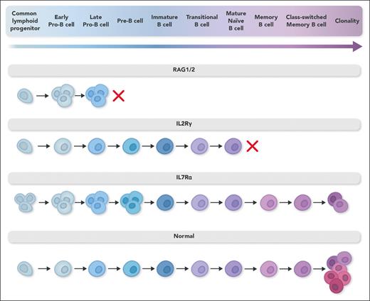 B-lymphocyte differentiation in diverse severe combined immunodeficiency genotypes. B-lymphocyte differentiation pathway in different gene defects associated with severe combined immunodeficiency. In RAG1/2 defects, an early developmental block leads to proliferation of early precursors filling the osteomedullary niche and failure of B-lymphocyte development. In IL-2Rγ defects, recipient B lymphocytes develop normally, but failure of signaling through the common γ chain of the IL-21 receptor abrogates B-lymphocyte proliferation, immunoglobulin isotype switching, and antibody secretion. In IL-7Rα defects, recipient B-lymphocyte precursors do not differentiate as effectively as normal cells because of lack of signaling through the IL-7R, leading to a smaller pool of cells with diverse IgH alleles and restricted mature B-lymphocyte receptor diversity. Professional illustration by Somersault18:24.